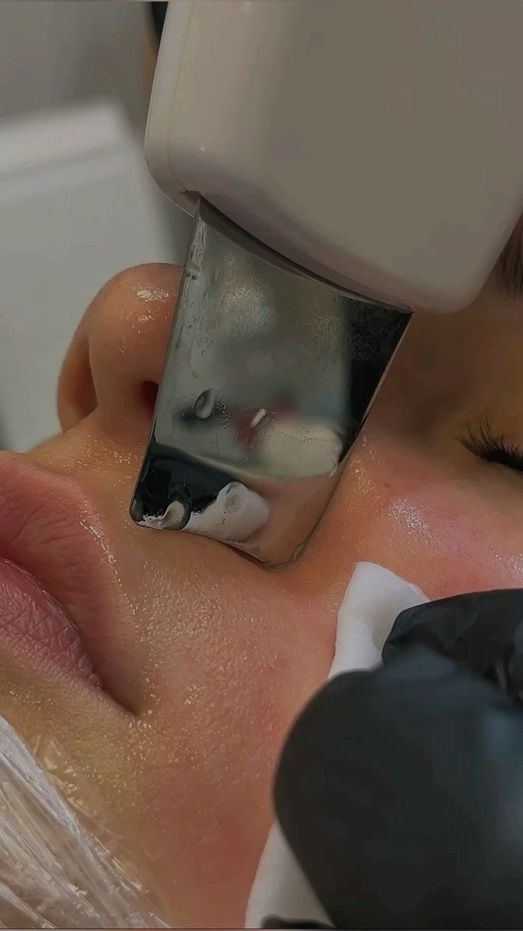 Procedură dermapen microneedling cu dispozitiv – Juvena Timișoara